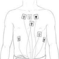 Холтеровское мониторирование